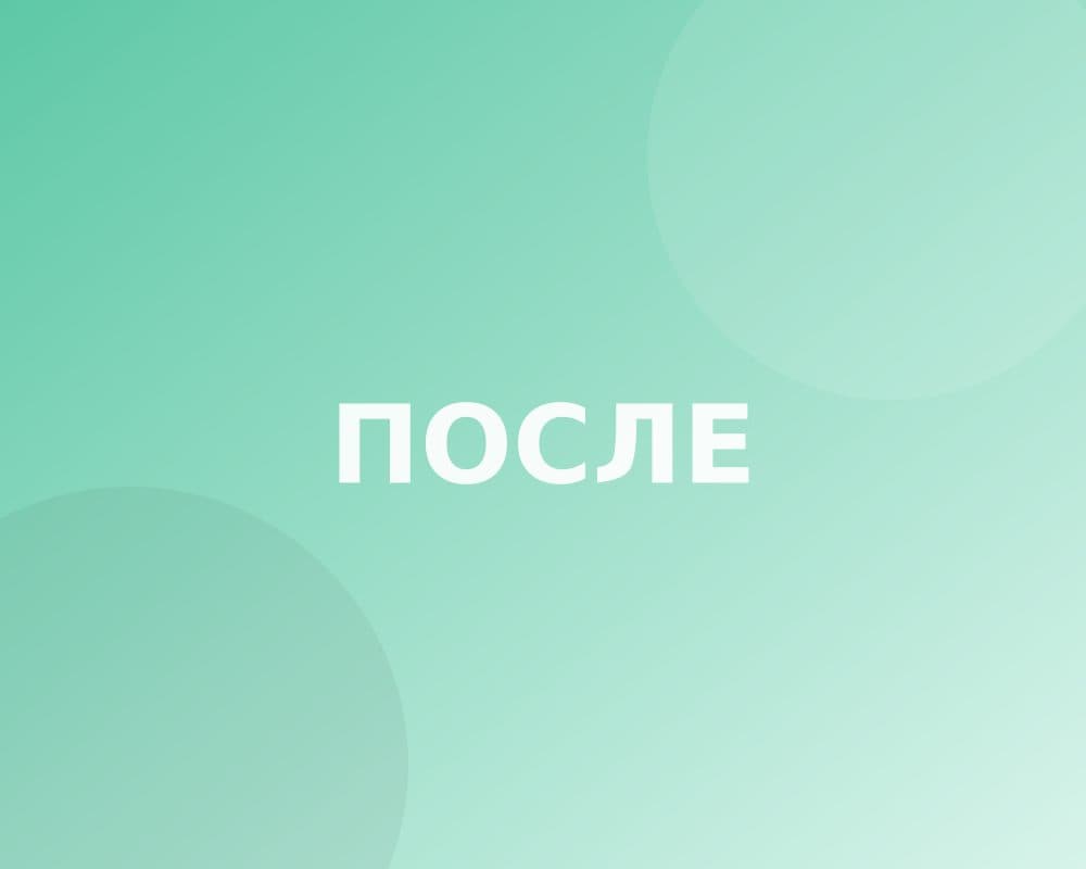 Работа «после»: Реставрация передних зубов